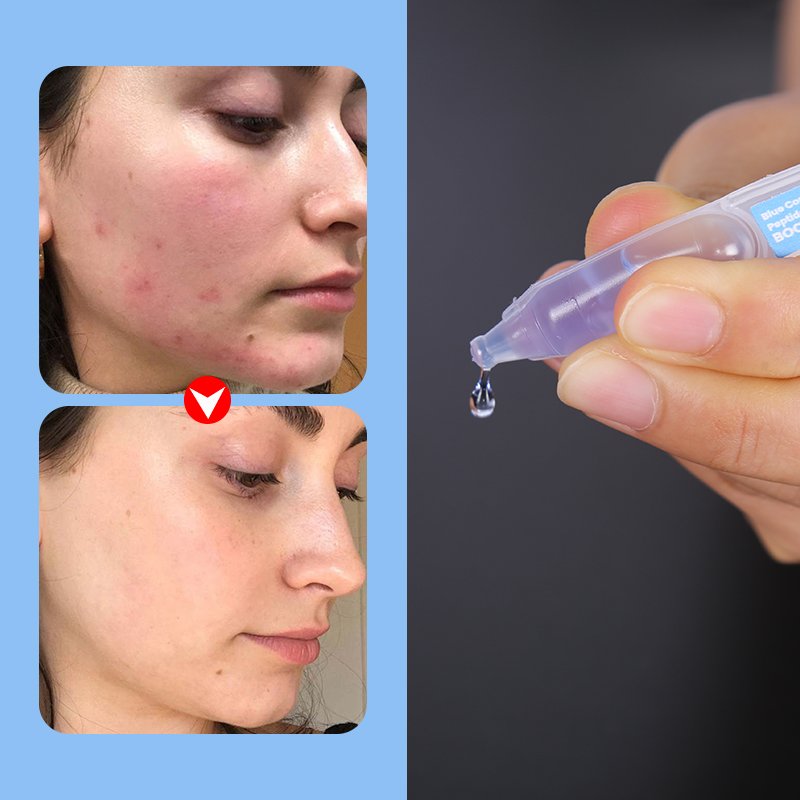Astaxanthin Peptide Repair Serum - 11